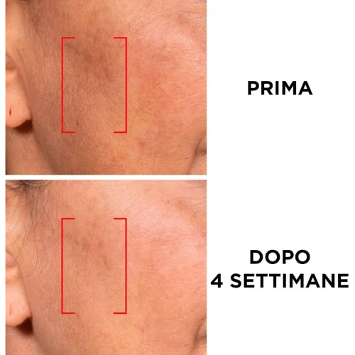 Prodotto