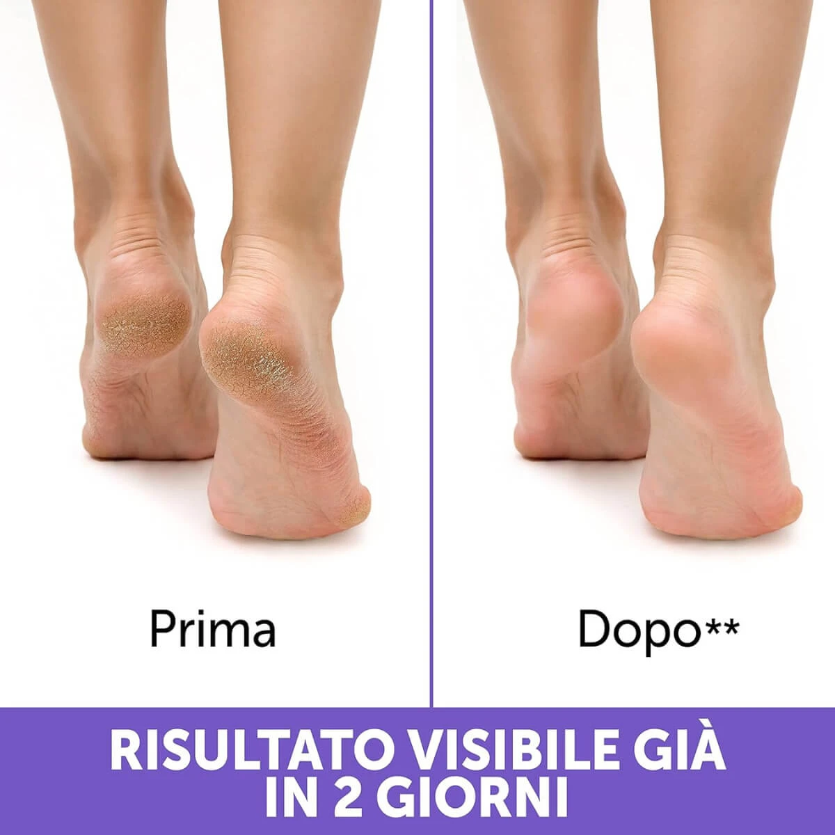 Prodotto